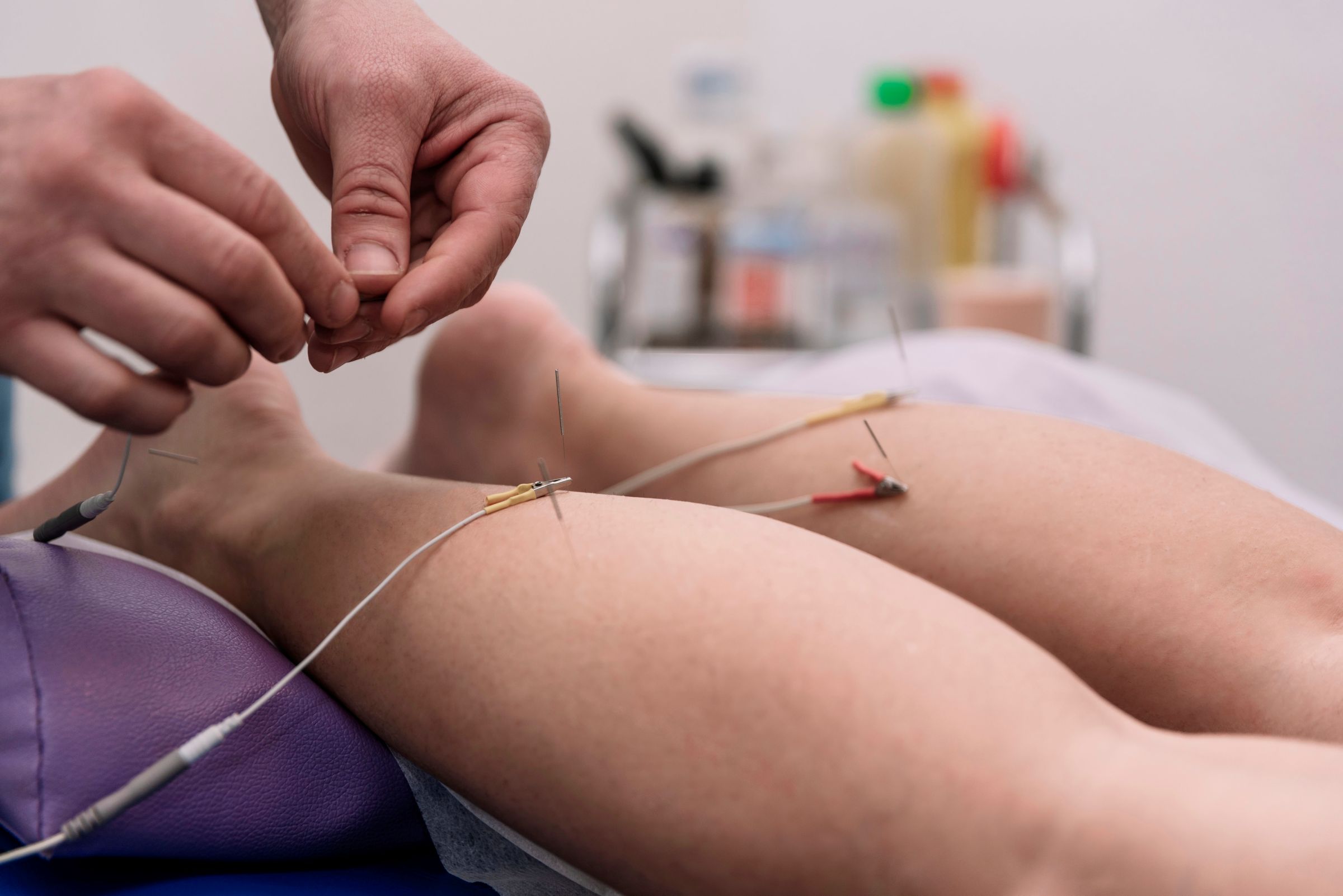 Nutrition & Acupuncture Wellness Center